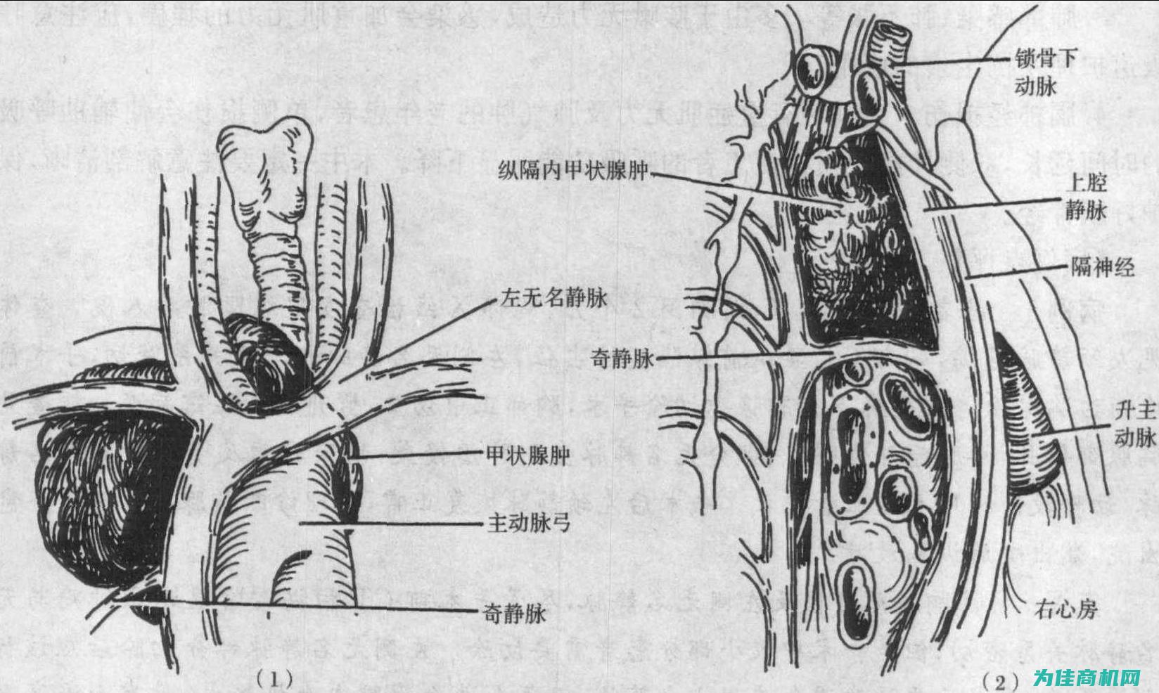 二、甲状腺消融治疗仪器图片一览 (甲状腺消炎药有哪些比较好)